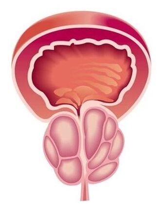 Symptome einer Prostatitis bei Männern